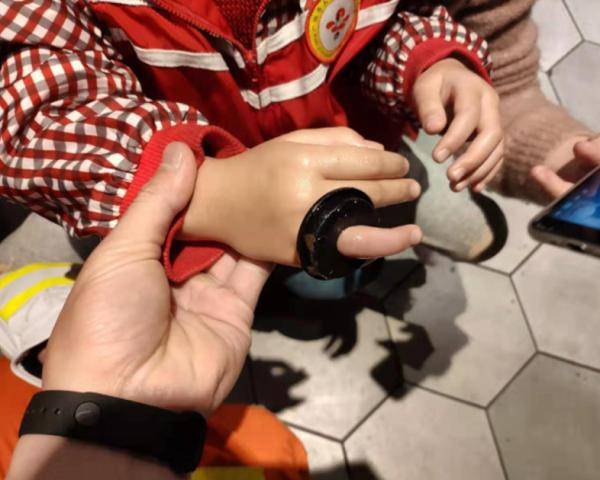 广州一小男孩上厕所时脚一滑,踩进去了……还卡住拔不出来_手指