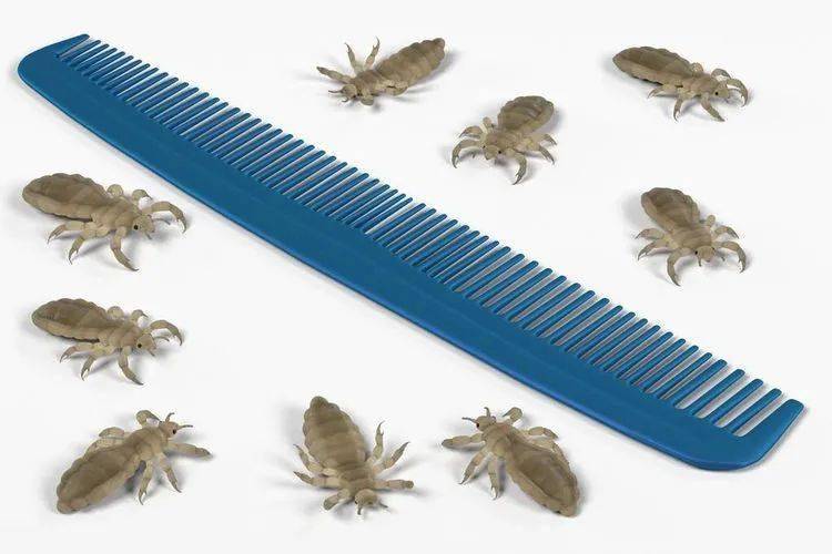 用什么可以去头上的虱子 a61645eb084543b29ca6892e091da374.jpeg