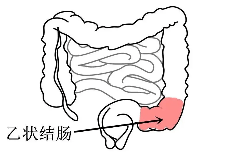 空肠袢图片