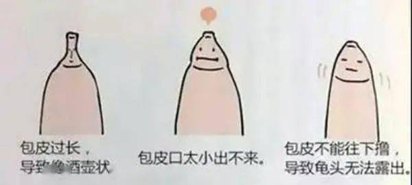 鸡扒照片图片