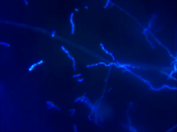 免疫荧光染色和传统染色效果对比图在荧光背景下即使是少量真菌菌丝