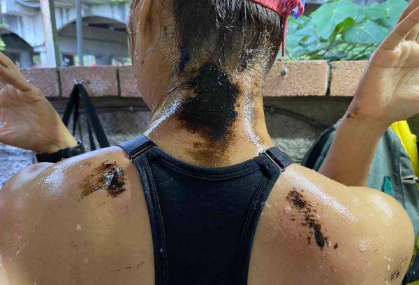 满身恶臭!高雄西子湾10多名泳客上岸后身体沾满黑油