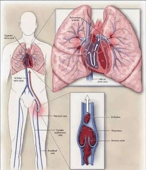 d9c26851a29f4943a0a75d1ef0e4504f.png