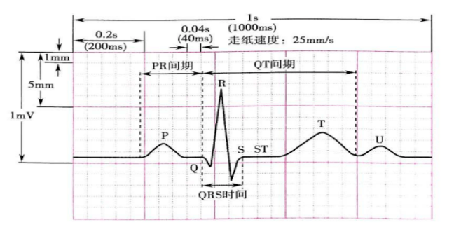 【航天心科普】心電圖知多少_心室