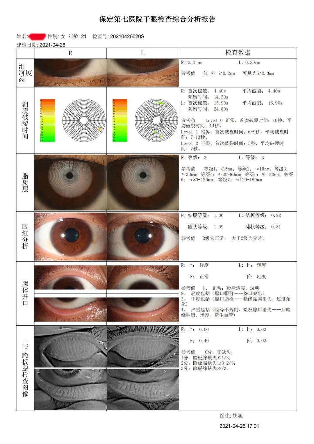 倦怠,分泌物粘稠,怕风及畏光,为外界刺激敏感,干眼症不仅影响舒适度