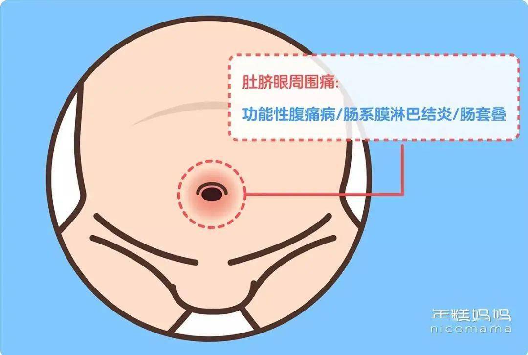「功能性腹痛病/肠系膜淋巴结炎/肠套叠」肚脐眼周围痛,可能是05尿路