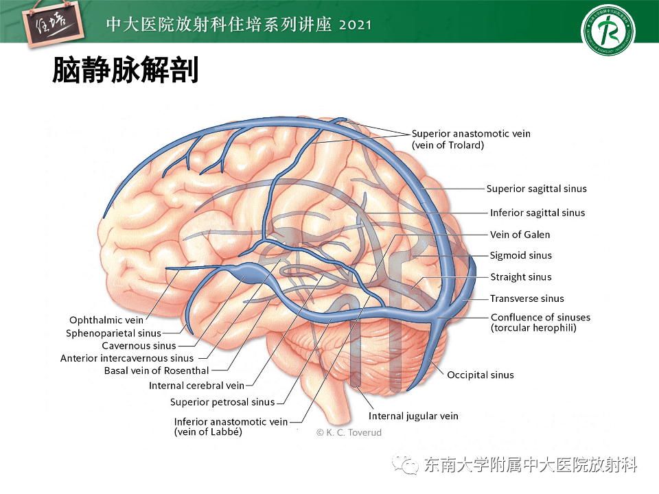 搭脉怎么判断早搏_早搏心电图怎么看图解(3)