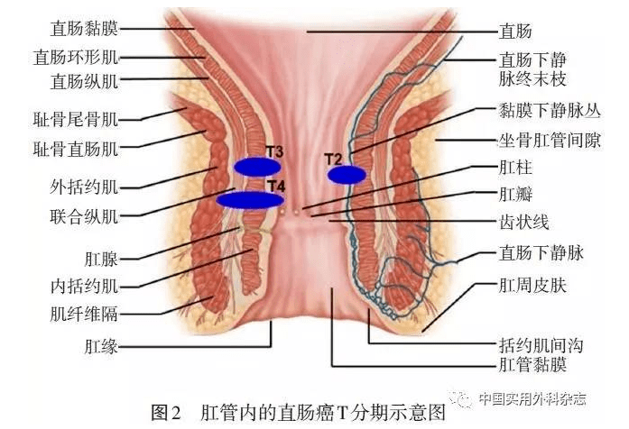 肛门内外括约肌位置图图片