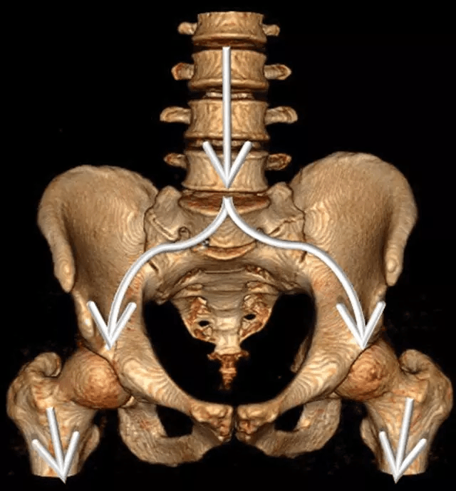 髋臼骨折的影像学表现