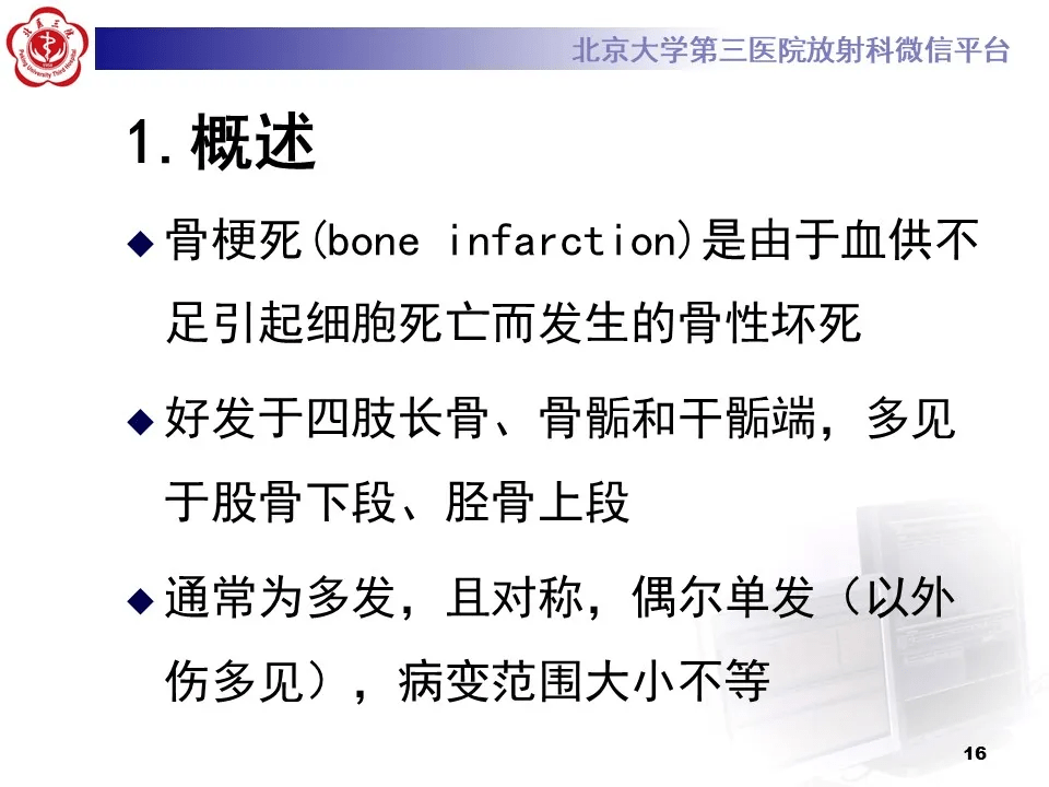 7a9da7ac85e4484bb1d56bc7a5314a11.png