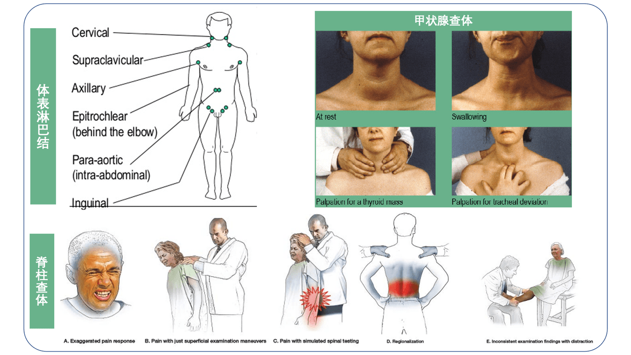 甲状腺触诊手法图解图片