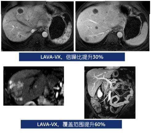 左肾结石怎么排出来最快方法 82771d4d73d44bc0ab4634e56cfd98eb.jpeg
