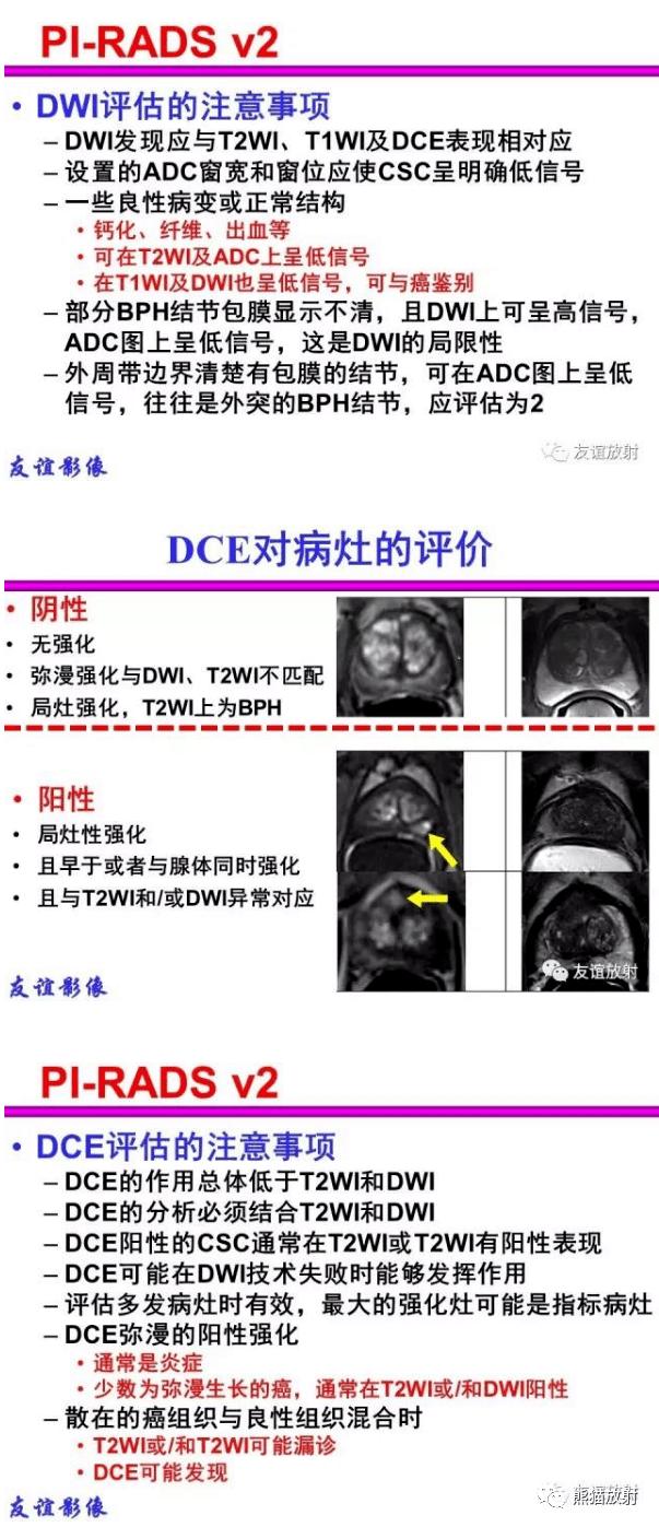 PI-RADS 前列腺影像报告和数据系统_诊断