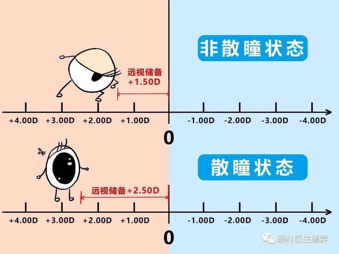 眼科醫生楊羿孩子的遠視儲備越多越不容易近視嗎