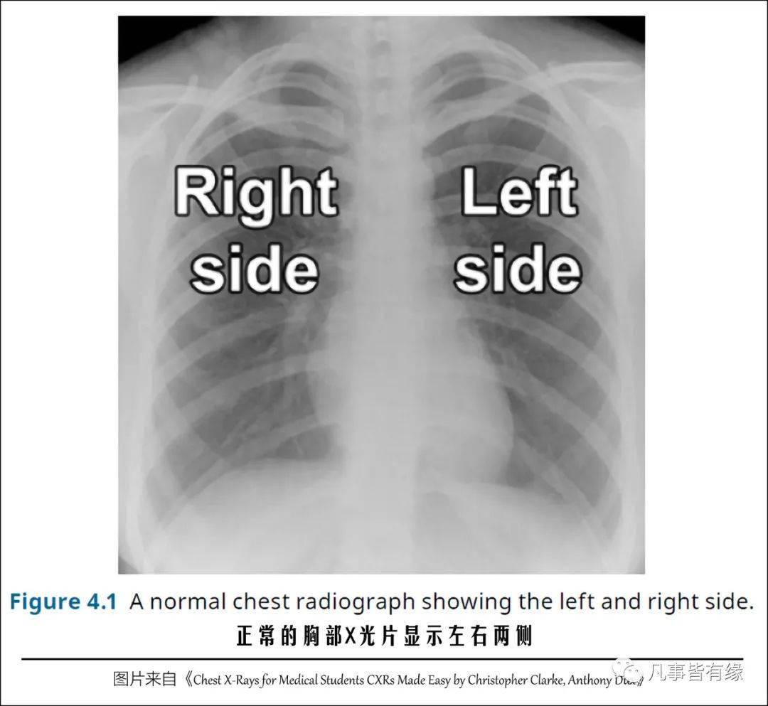 全胸片正常解剖胸部及心肺基礎知識複習