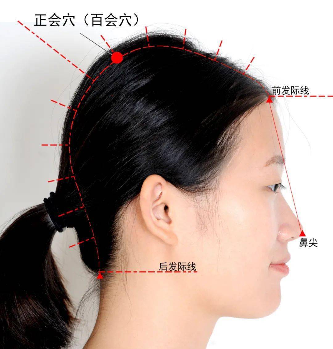 百会凹陷相学图片