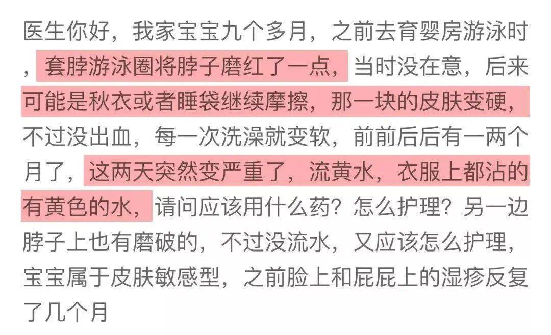 夏天最坑娃的宝宝用品,家里有的赶紧扔掉!