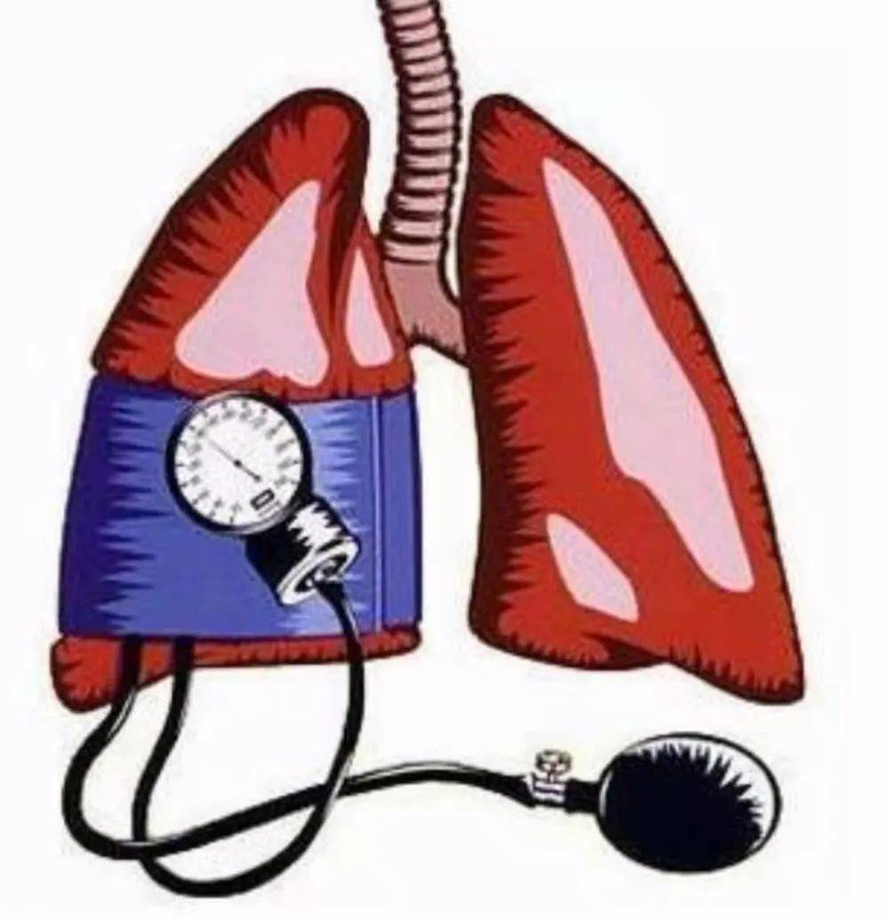 妊娠合并肺动脉高压二