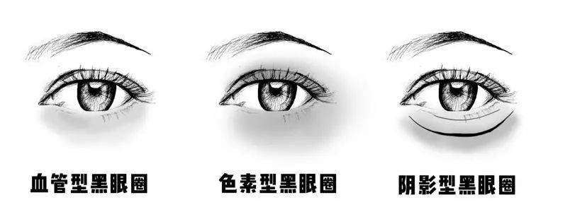 你了解你的黑眼圈吗