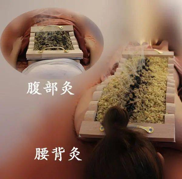 宝是时候贴了贴什么冬病夏治的三伏贴