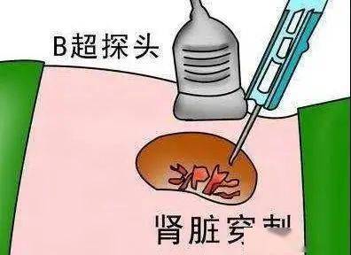 什么是单纯性囊肿 12a9d4813ea0414197270d0c85d5866b.jpeg