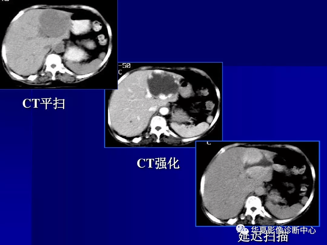 圖文詳解完整版肝膽胰脾影像診斷