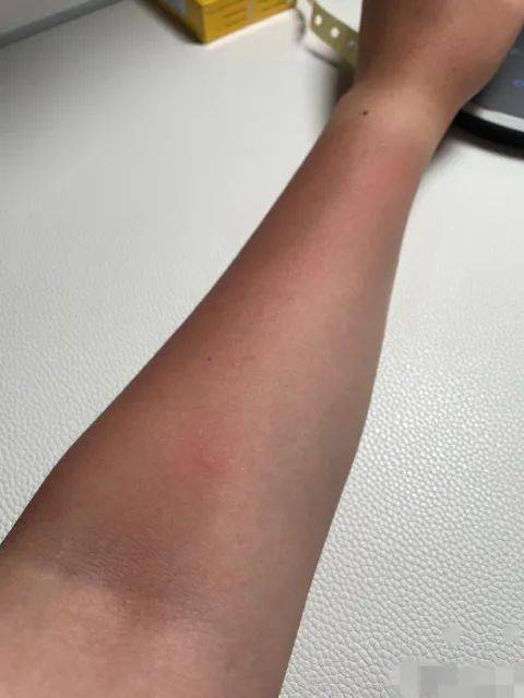 央视记者追踪大象被晒黑…云南的紫外线到底有多强?