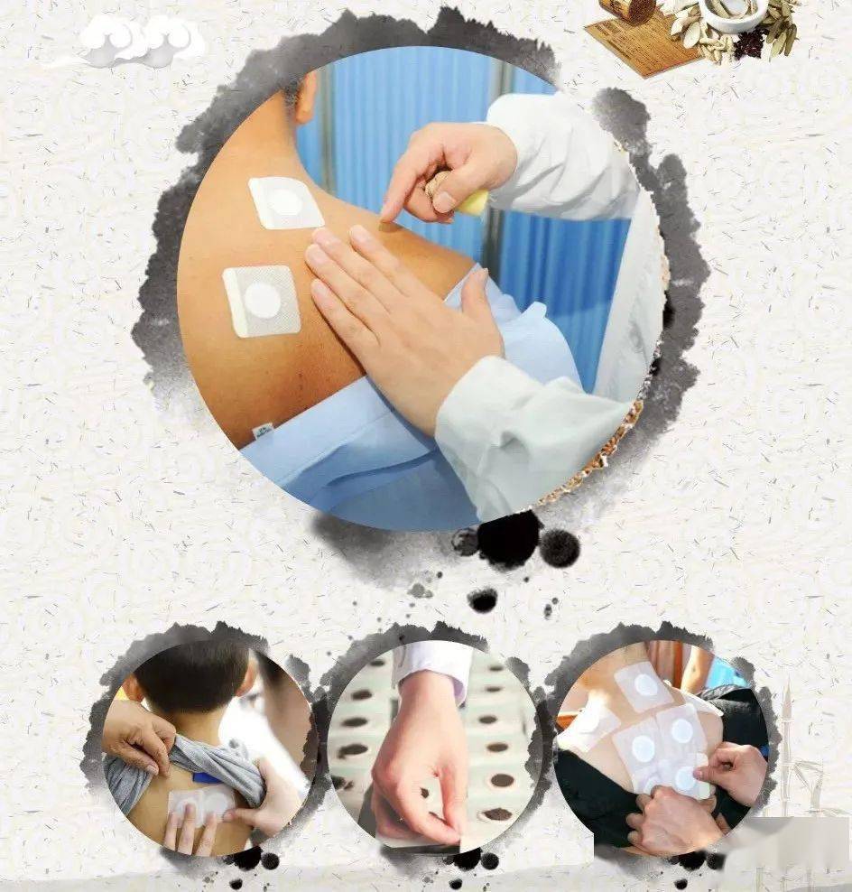 三伏贴来啦这几类人可以看一看