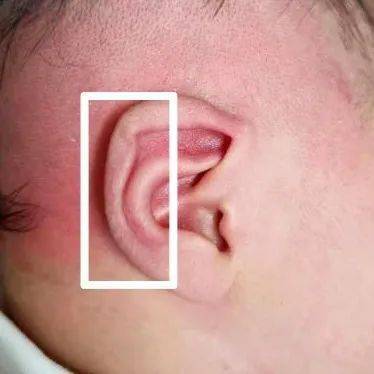 耳朵上有折痕代表什么图片