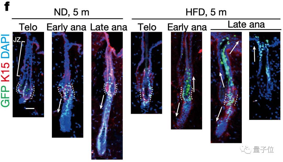 干细胞|太胖就会变秃，这回真的有依据了，日本学者发现肥胖会诱导毛囊衰竭