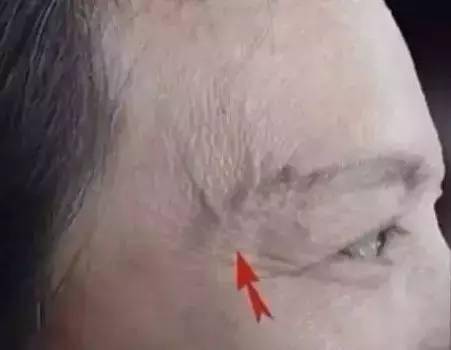 这个部位长青筋非死即残