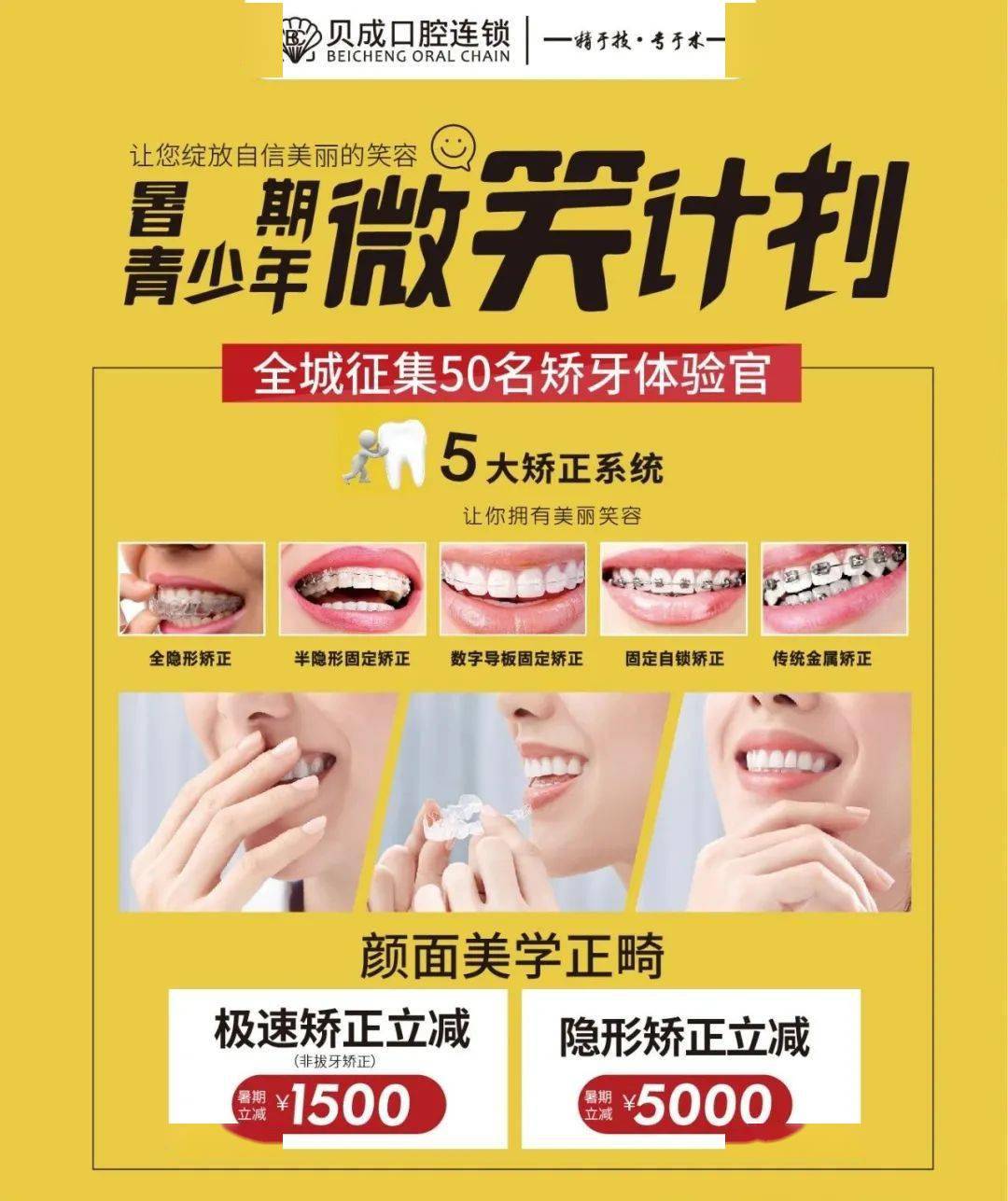 全城征集50名矫牙暑期正畸微笑计划终于来了别让青春留遗憾