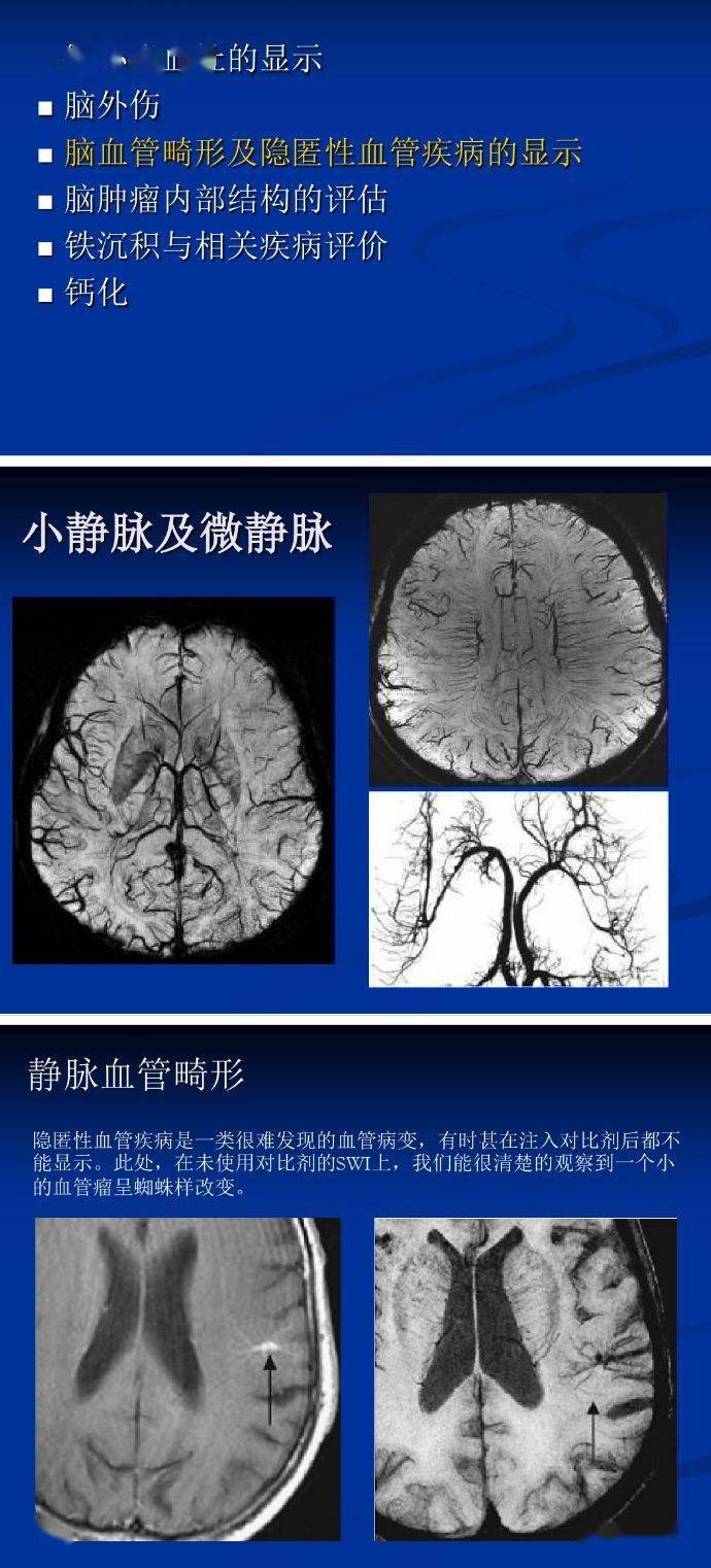 swi相位图和幅度图图片