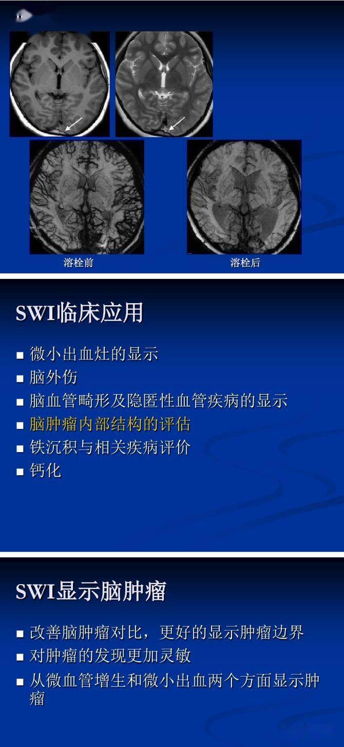 可同时获得幅度图像(magnitude image)和相位图像(phase image)