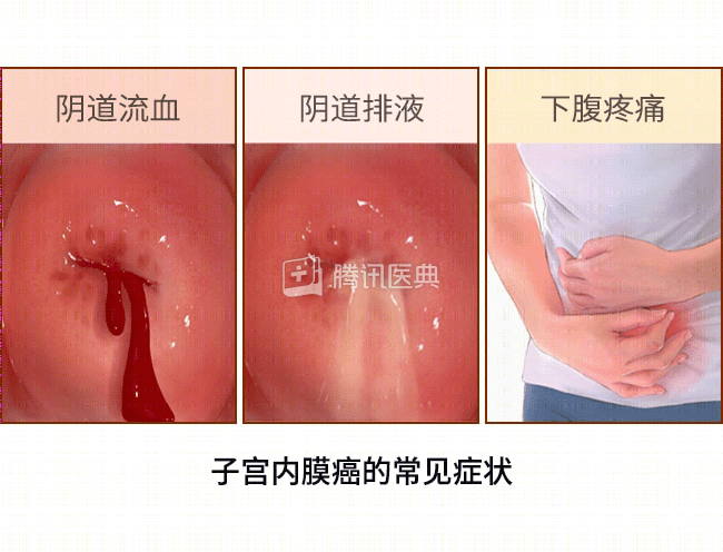 17f74cd1eb0f4b549085939a87a12fe9.png