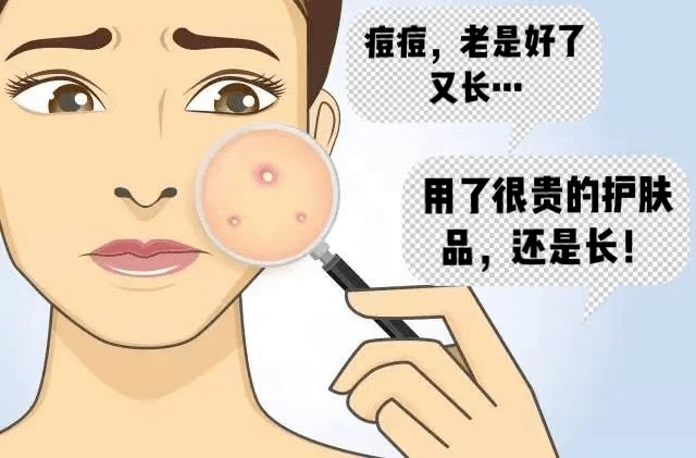 痘痘肌全体起立你和痘痘冤家路窄全都要怪它