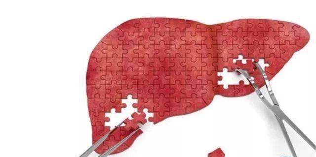 生活|科普 | 乙肝小三阳，需要吃药吗？