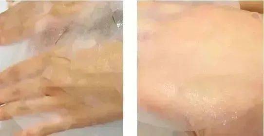 蒂佳|皮肤状态差？用它，20分钟搞定！