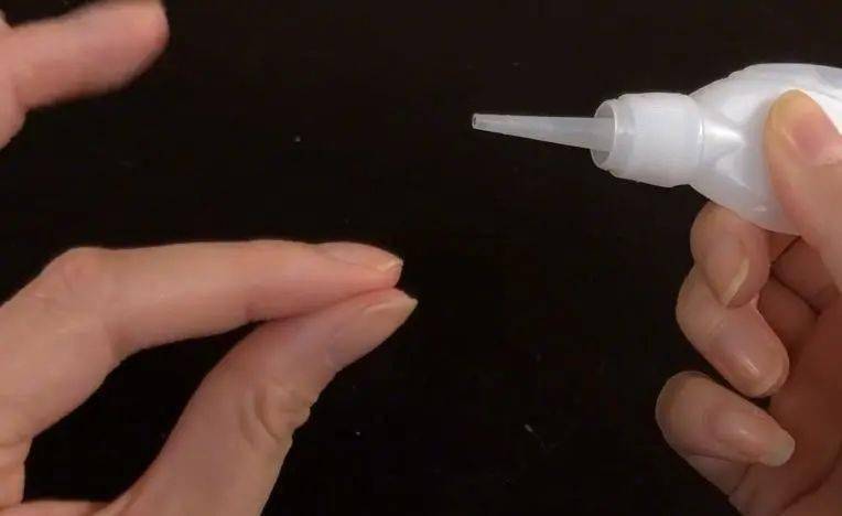 遭到他人恶作剧南宁两个小女孩手掌被502胶水粘住分不开