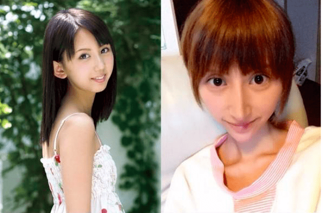 33岁网红抽脂感染去世疯狂整容背后的真相是什么