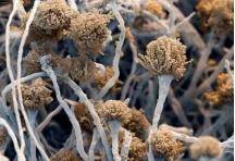 抵抗力|肺发霉？！杭州女子反复咳嗽10多年，医生从肺里“挖”出“臭鸡蛋”