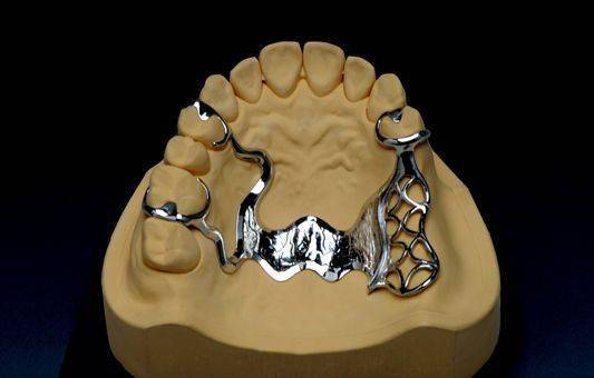 口腔可摘局部义齿支架设计大全_基牙