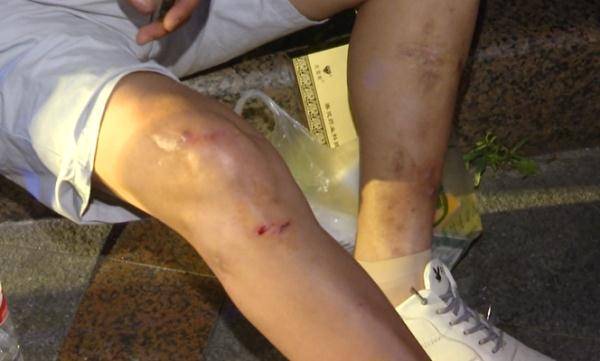 男子在贵阳一水上乐园摔骨裂,称地面太滑!园方:怎么摔的你心里没数?