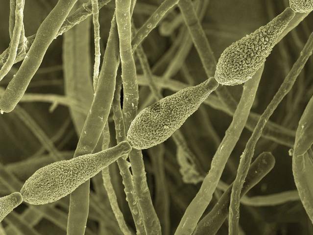 过敏性鼻炎,避免接触过敏原是治疗之本_花粉