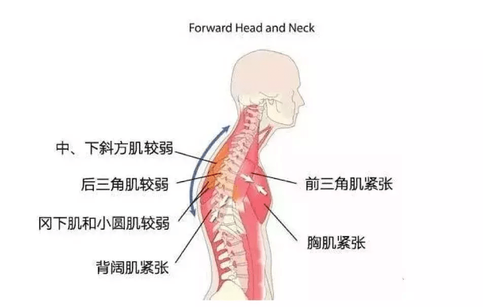 如何强化背阔肌?一组动作练出好看的美背,提高体态气质