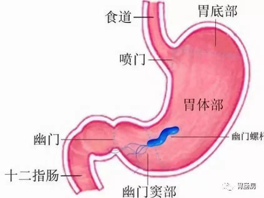 胃角的位置图片