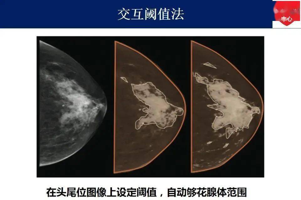 乳腺头尾位图片图片