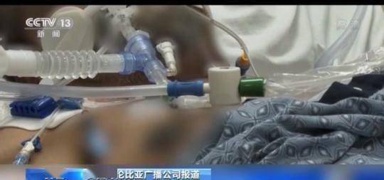 时间|病毒出现时间不断提前 究竟谁是美国“零号病人”？