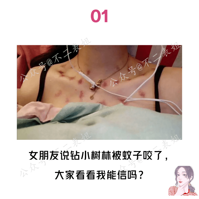 女友锁骨上有好多奇怪的淤青,大家看她这么解释我该信吗?