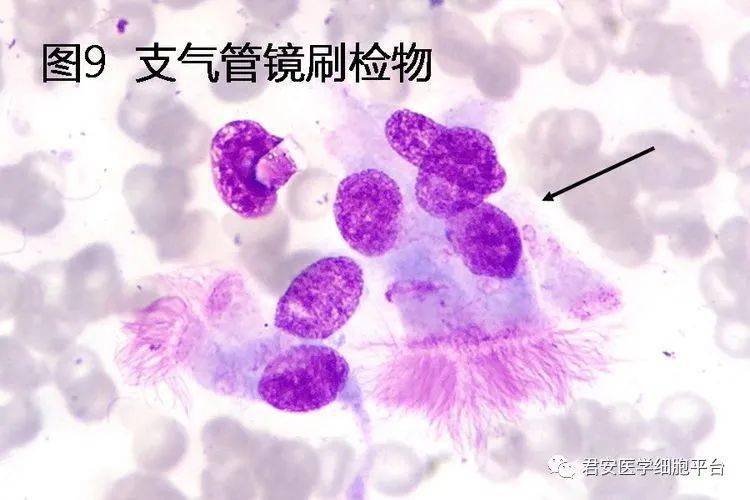 ▼「纤毛柱状上皮细胞」形态特征:胞体较长,呈柱状或锥状,一端覆有